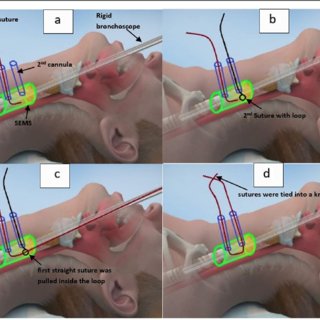 Nudos y puntadas: Técnicas esenciales de costura y atado paso a paso